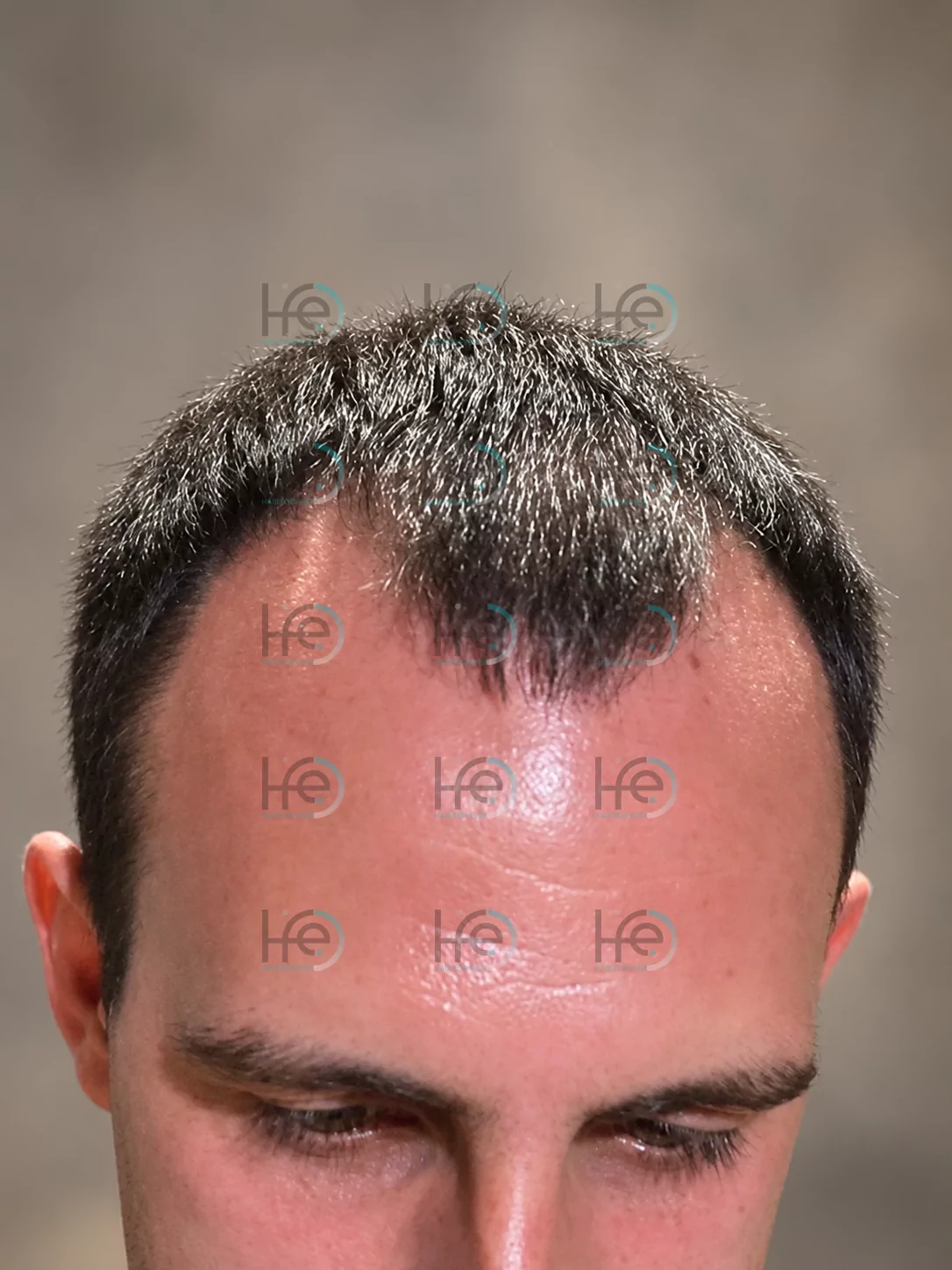 до