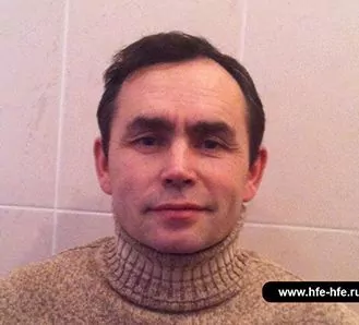 Результат пересадки волос методом hfe